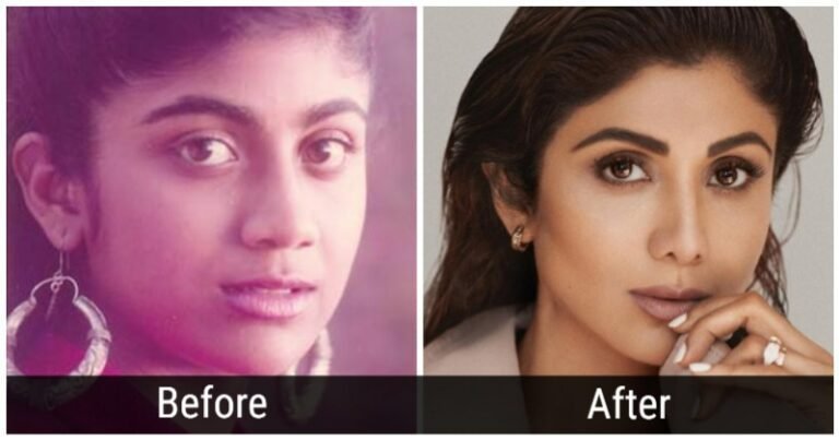 Bollywood Celebrities Who Promote Body Positivity But Have Themselves Gotten Plastic Surgery