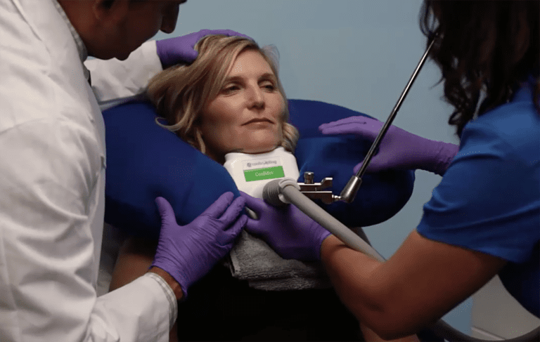 Stubborn fat meets its match: Sculpting away the double chin