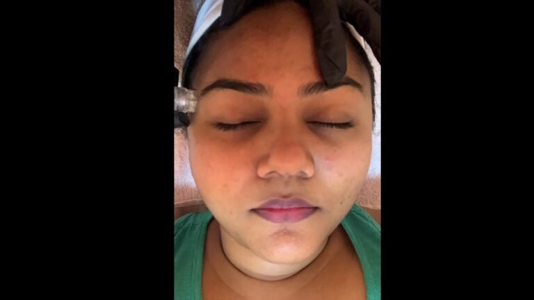 Microinfusion Facial Treatment in Bangalore by Anjali Sanghvi.