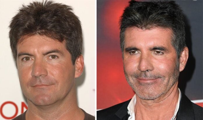 Simon Cowell’s drastically different face - Botox, ‘too much’ filler and £2k facelift  | Celebrity News | Showbiz & TV