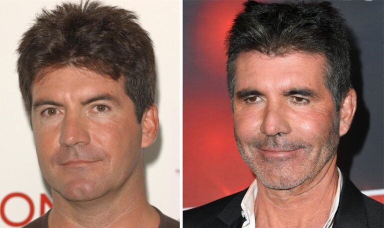 Simon Cowell’s drastically different face – Botox, ‘too much’ filler and £2k facelift  | Celebrity News | Showbiz & TV