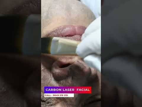 Things That Make You Love Carbon Laser Facial Treatment. | Viral #shorts