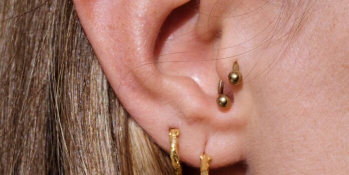 Everything to Know About Migraine Piercings—Do They Really Work?