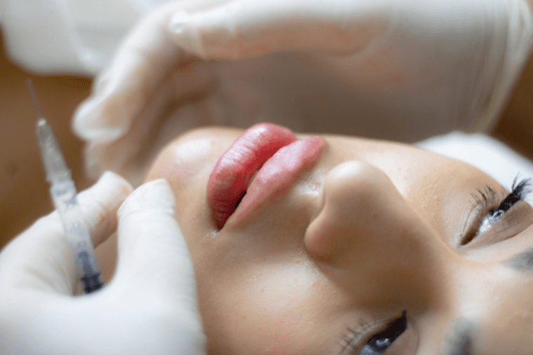 Want to get fillers? Here’s everything you need to know first – Emirates Woman