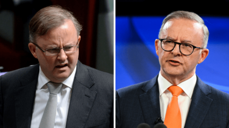 Prime Minister Anthony Albanese Botox rumours: PM addresses cosmetic surgery rumours