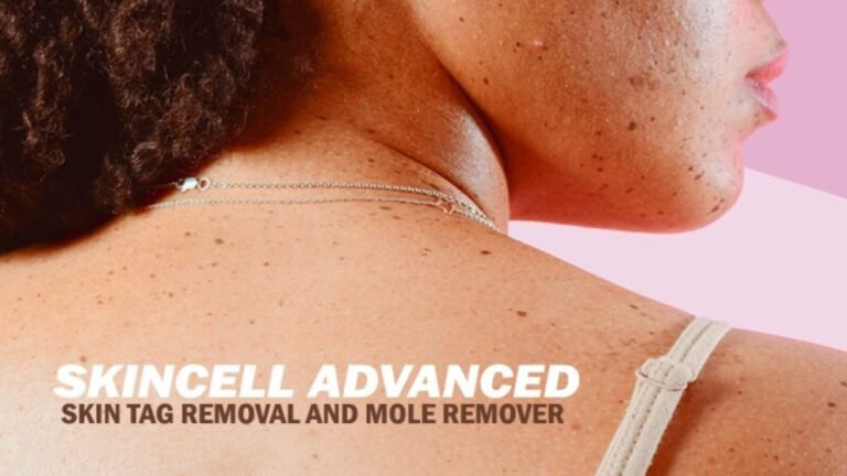 Legit Skincell Skin Tag Removal and Skincell Mole Remover or Another SCAM