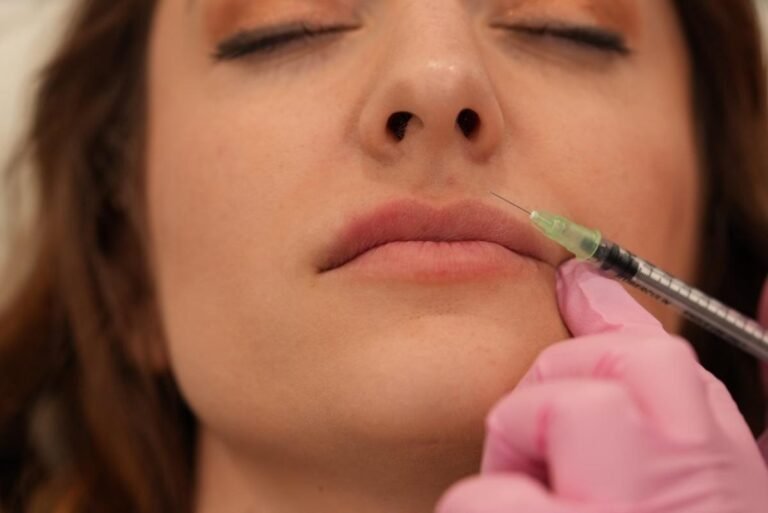 Why ‘Lip Flip’ Filler Treatment Is ‘So Wildly Popular During the Holidays’