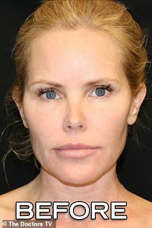 Baywatch star Gena Lee Nolin, 50, shows off INCREDIBLE results of her ‘silent face lift’