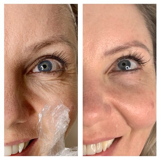 Daylesford Beauty Salon’s Life Changing Skin Treatments