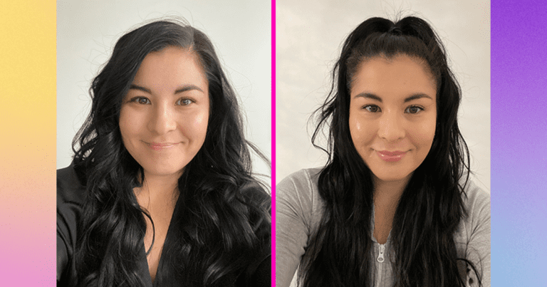 I Tried It: I Got Lip Fillers — and It Didn’t Really Hurt
