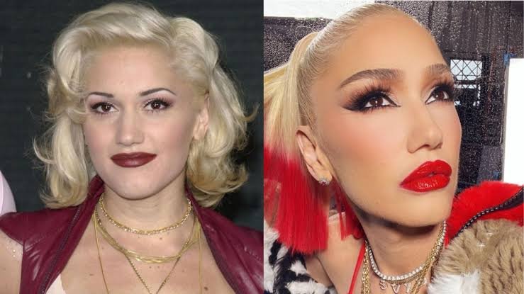 Did Gwen Stefani Undergo Plastic Surgery? Before and After Photos Explored