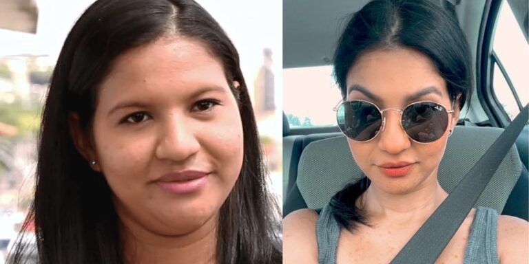 How Karine’s Face Changed After Dramatic Weight Loss