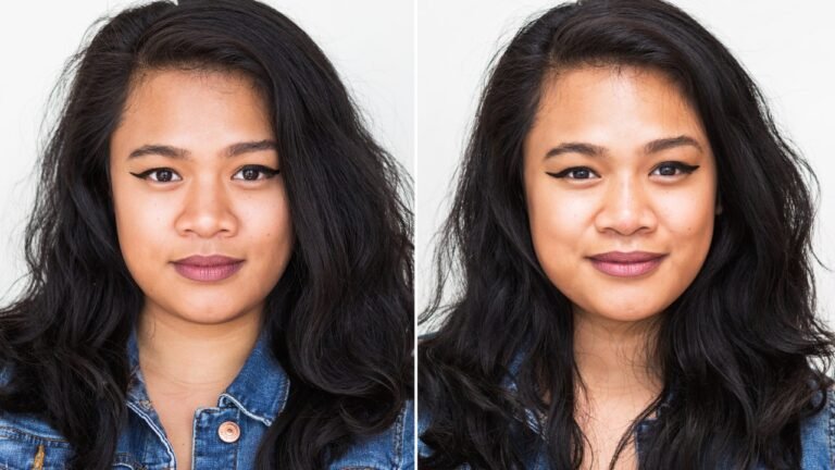 I Got a Non-Surgical Nose Job, and Here’s What Happened