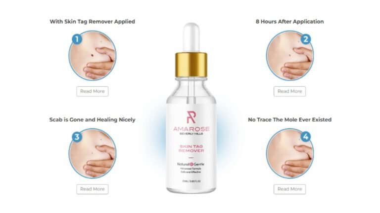 [BE INFORMED] Amarose Skin Tag Remover Reviews SHARK TANK Scam of Mole Removal