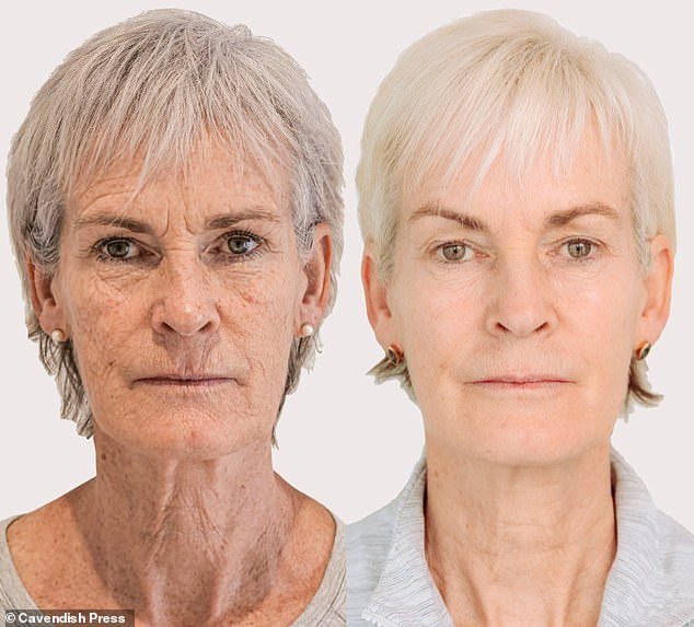 Judy Murray reveals results of £4,500 non-surgical facelift which makes her look 10 years younger