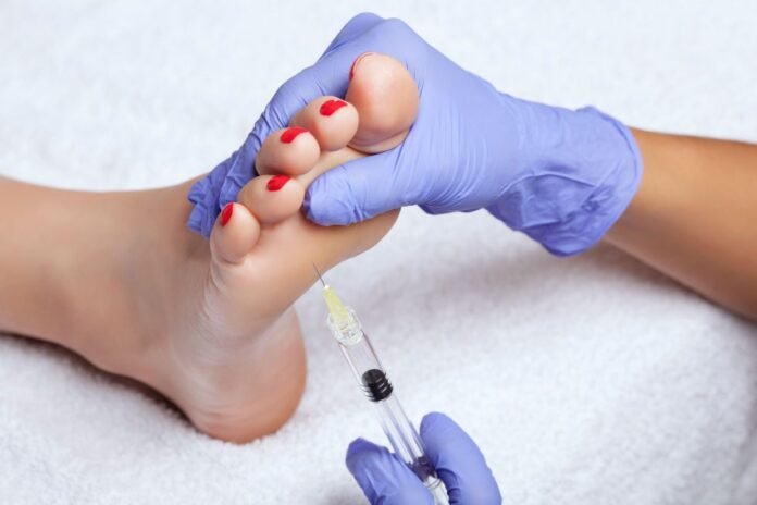 Not just for getting a youthful-looking face, botox is being used on the feet...