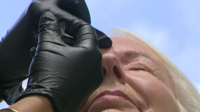 Houston area surgeon treats persistent eye spasms with botox