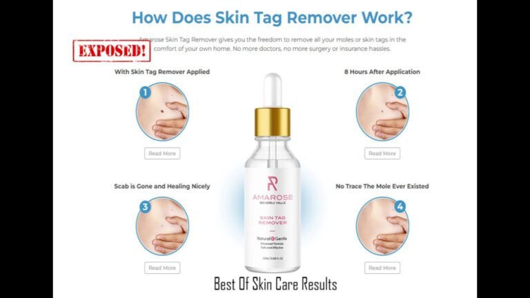 Amarose Skin Tag Remover | Best Skin Tag Remover