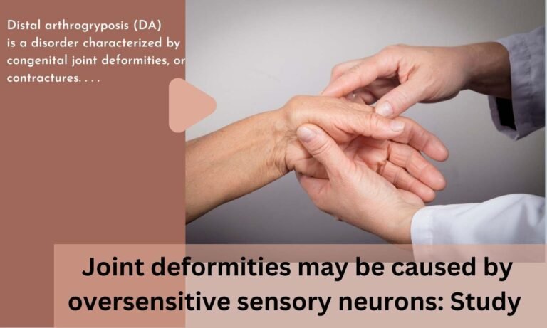 Joint deformities may be caused by oversensitive sensory neurons: Study