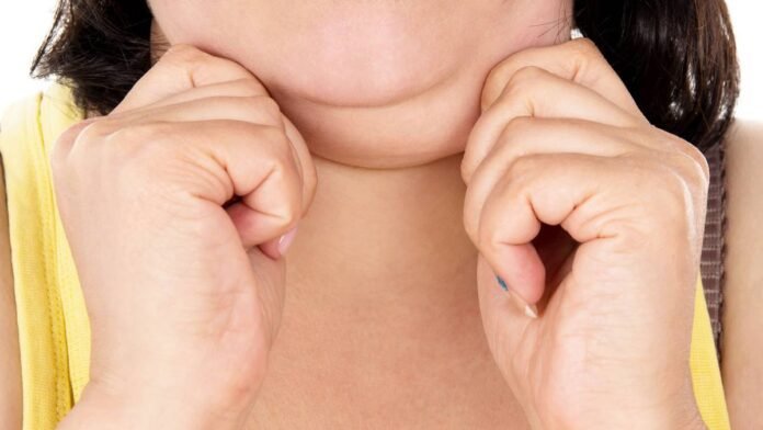 New injection treatment Belkyra promises to destroy fat cells that cause double chins