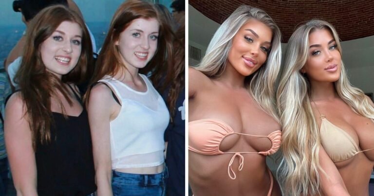 The 14 biggest Love Island transformations of all time, before and after