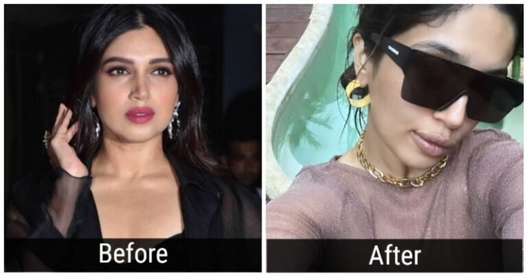 Bhumi Pednekar Brutally Trolled For Alleged Lip Job, Gets Compared To A Duck